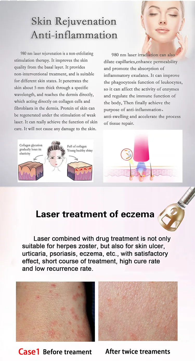 980Nm Laser Diode Vascular Spider Varicose Vein Removal Machine Treatment Fungi Physiotherapy