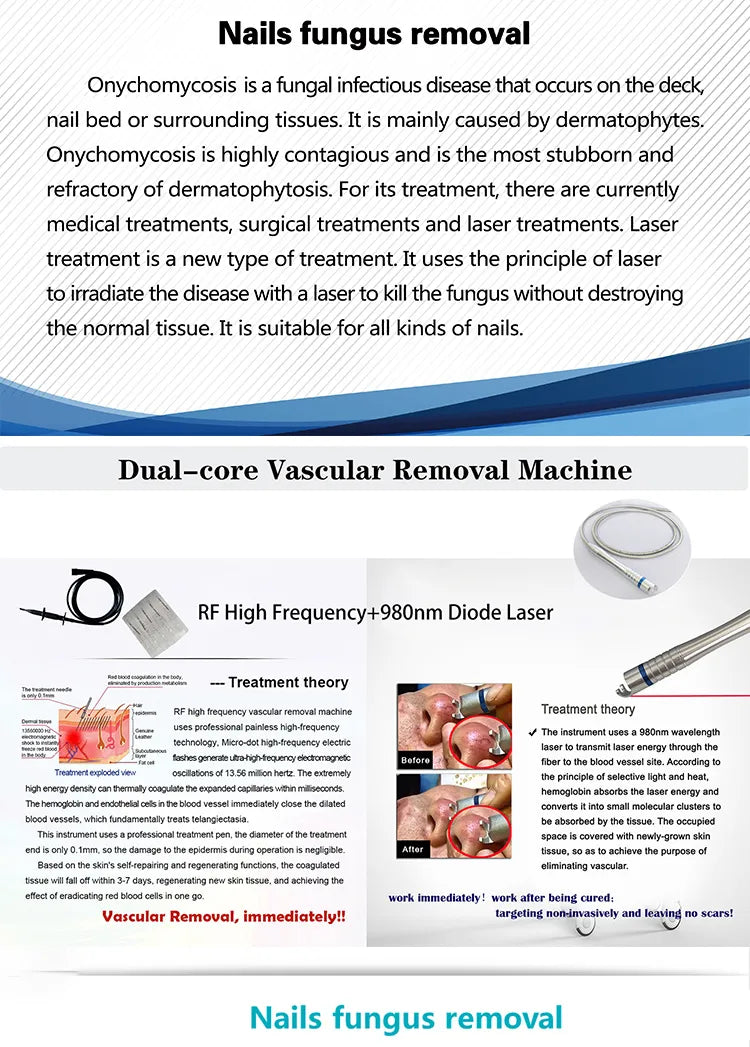 980Nm Laser Diode Vascular Spider Varicose Vein Removal Machine Treatment Fungi Physiotherapy