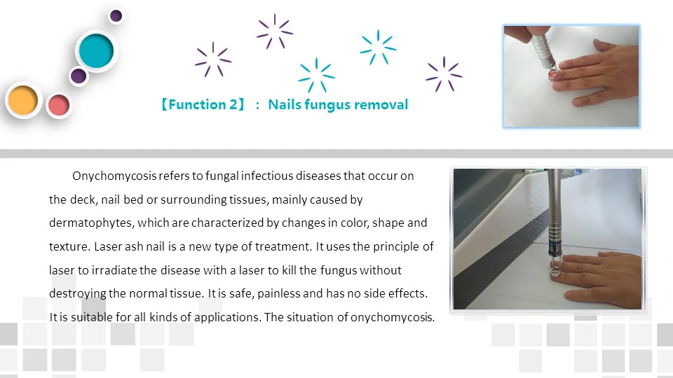 980Nm Laser Diode Vascular Spider Varicose Vein Removal Machine Treatment Fungi Physiotherapy