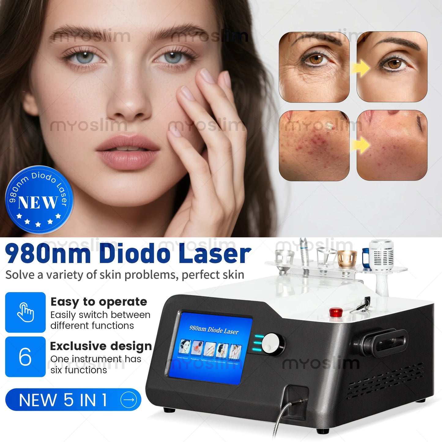 5-in-1 980nm Diode Laser To Remove Blood Vessels Nail Fungi To Remove Skin Eczema Restore Physical Body Therapy Beauty Functions