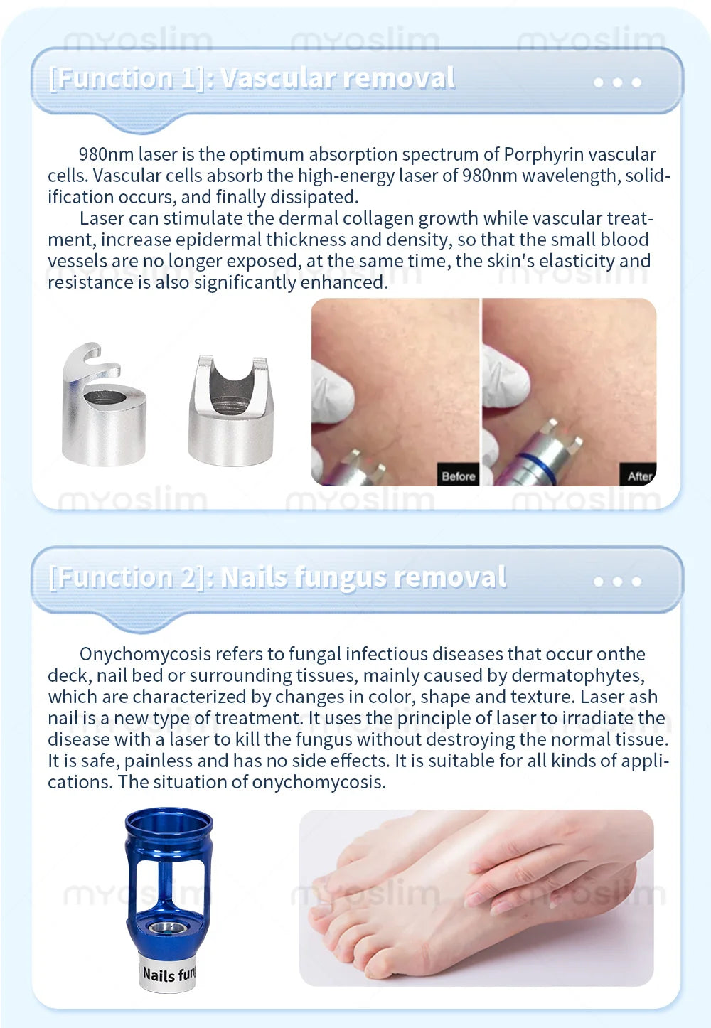 5-in-1 980nm Diode Laser To Remove Blood Vessels Nail Fungi To Remove Skin Eczema Restore Physical Body Therapy Beauty Functions